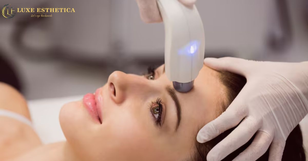 Photofacial Benefits– How It Improves Skin Tone & Glow