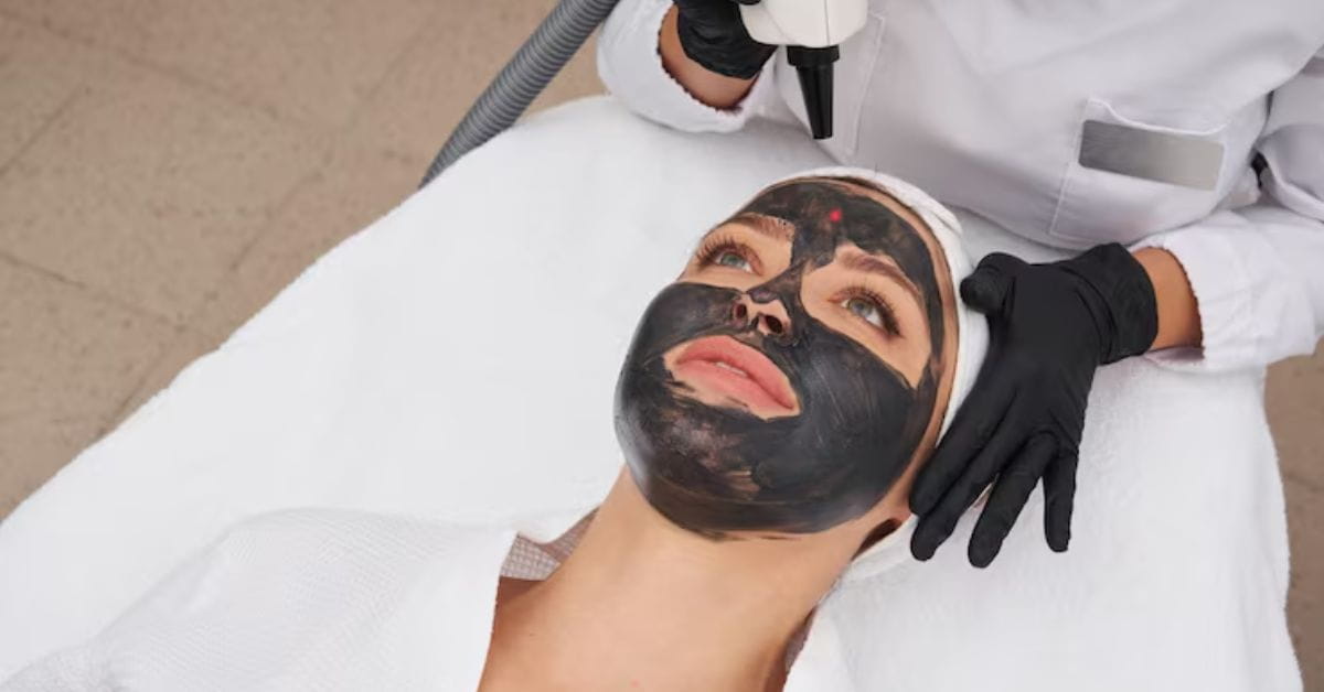​What is a Carbon Peel Facial